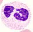 Segmentkerniger Neutrophiler